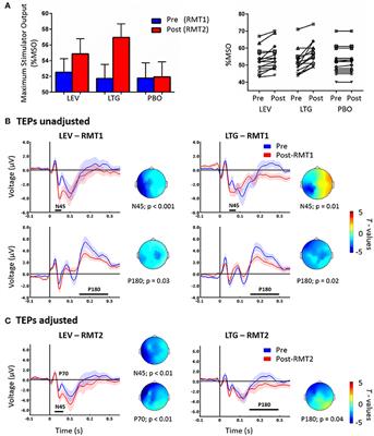 The Effect of Lamotrigine and Levetiracetam on TMS-Evoked EEG Responses Depends on Stimulation Intensity